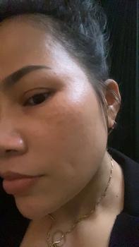 Product Review of Meso trannacix pháp lẻ 1 ống 2ml công ty from T**h T**ý 0