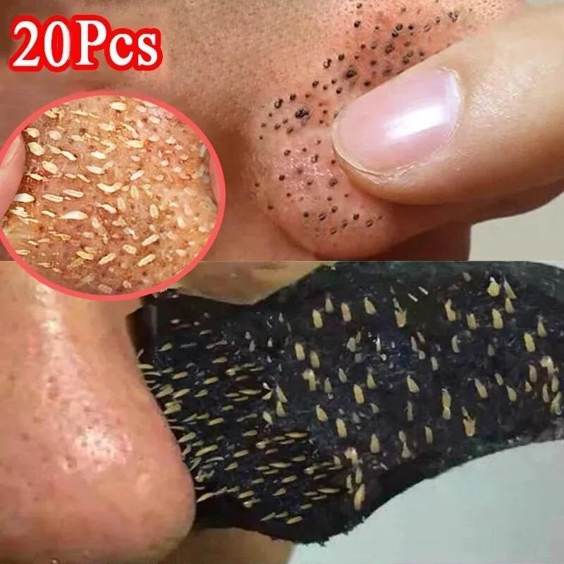 50/80 PCS Nose Blackhead Remover Mask Deep Cleansing Skin Care Shrink Pore Acne Treatment Mask Nose Black dots Pore Clean Strips 4