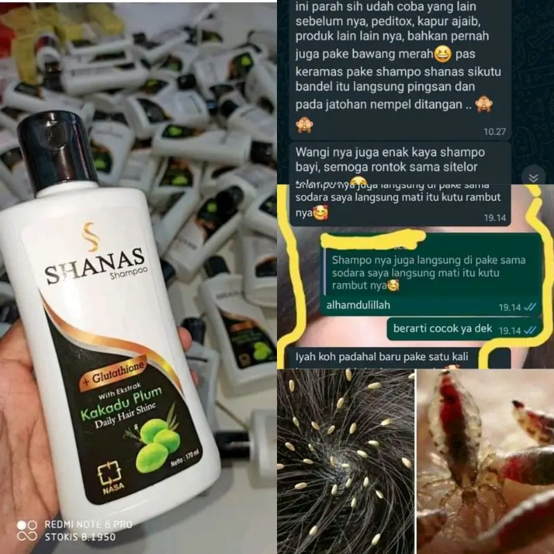 SHAMPO SHANAS 3IN1 ANTI KUTU ANTI RONTOK Shampoo