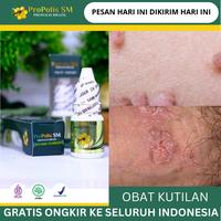 Gambar PROPOLIS SM 100% Original Perontok Kutil Dileher, Kutil Papiloma, Perontok Skin Tag, Kutil Di Wajah, Perontok Kutil Kelamin, Kutil Kelamin HPV, Kutil Kelamin Pria, Kutil Kelamin Wanita, Benjolan Kecil Pada Kemaluan dari irvan herbal store Kota Administrasi Jakarta Barat 1 Tokopedia