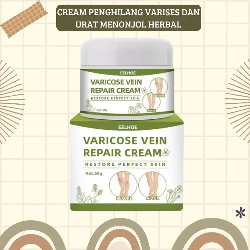Terlaris !!! Varicose Veins Treatment Cream/Obat Krim Varises Parises Tanpa Operasi