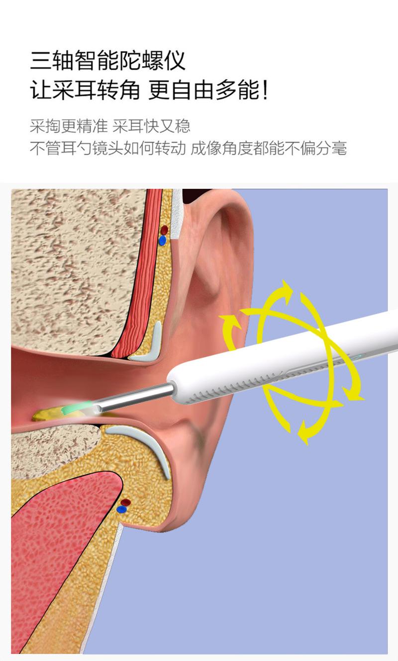 Product Introduction of Dụng Cụ Ngoáy Tai WiFi Không Dây, Camera Otoscope, Ống Nghe, Phát Sáng, Làm Sạch Ráy Tai, Kiểm Tra Răng Miệng, Chăm Sóc Sức Khỏe, Máy Làm Sạch Tai 27