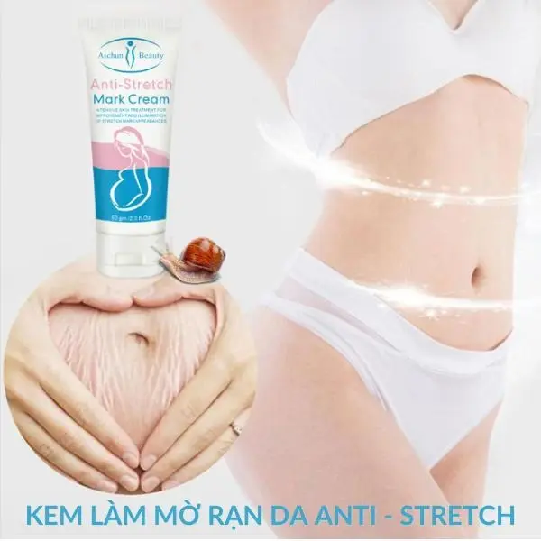 Kem rạn da kem da Ati-stretch Marks Cream - mờ sẹo, giảm nhăn, săn chắc, trắng mịn, dùng được cho cả rạn đỏ và rạn trắng