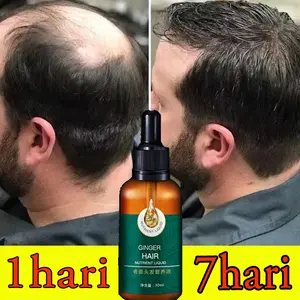 obat ampuh untuk rambut perontok parah-penumbuh rambut secara cepat-obat penumbuh rambut botak-hair tonic penumbuh rambut-penumbuh rambut botak pria-penumbuh rambut botak wanita-Serum Anti Botak Rambut-penumbuh rambut cepat dan tebal-Pencegah Rambut Ronto