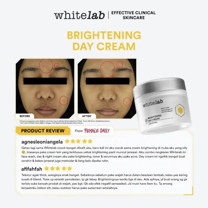 Whitelab Brightening Day Cream - Pelembap Krim Pagi Pencerah Wajah Untuk Kulit Kering Dengan Niacinamide, Hyaluronic & Collagen serum 3