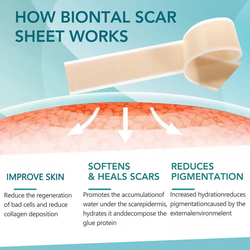 Silicone Scar Sheet, Reusable Scar Sheets, Professional Scar Removal Tool for C-section, Surgery, Burn, Keloid, Acne, Skincare Tools, Korean Skincare Products, Improves, Scar Gel 3