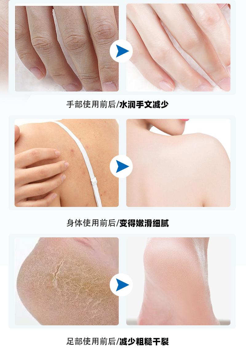 Product Introduction of Kem Nứt Da, Ubi, Cho Tay Và Bàn Chân, Chăm Sóc Làm Dịu Và Dưỡng Ẩm, Thích Hợp Cho Mùa Thu Và Mùa Đông, Phục Hồi Chống Đóng Băng Và Chống Nứt Nẻ, Dưỡng Ẩm Và Nuôi Dưỡng 4