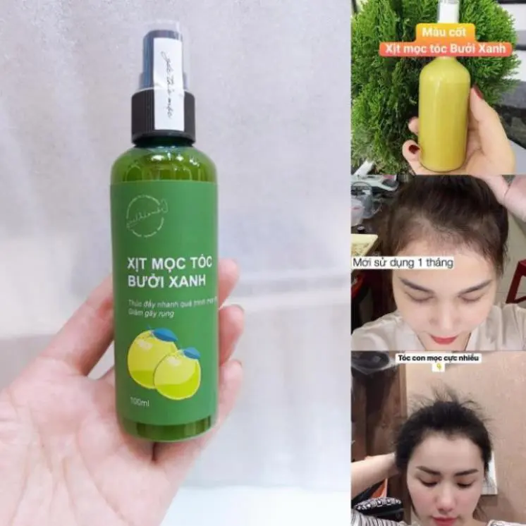 Xịt Mọc tóc BƯỞI XANH, KÍCH THÍCH MỌC TÓC SAU 10 NGÀY SỬ DỤNG