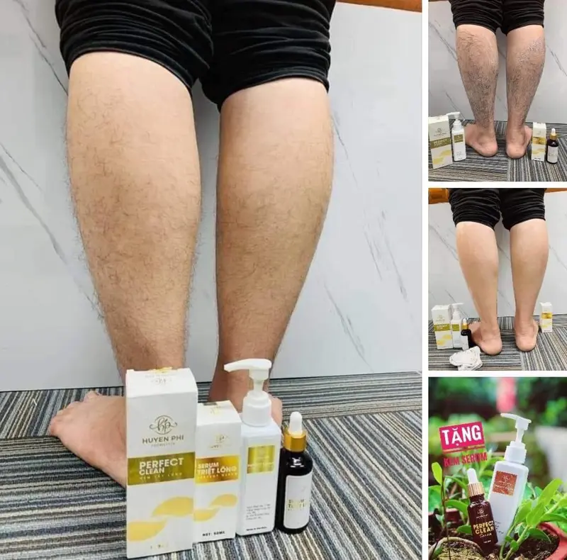 Kem Tẩy Lông Huyền Phi (TẶNG KÈM 1 SERUM TRIỆT LÔNG) an toàn tại nhà không cần đi spa 3