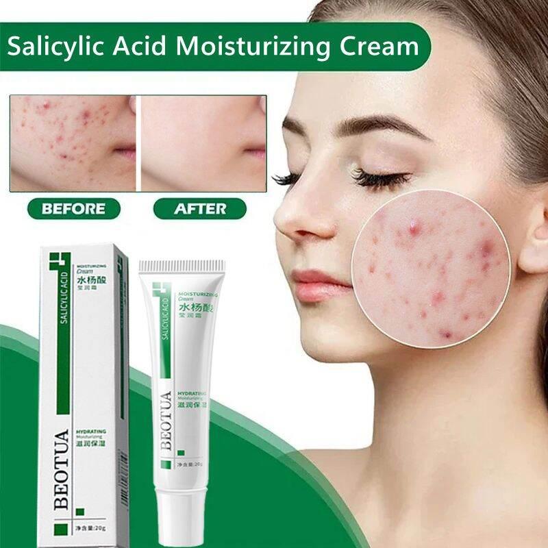 Kem Thu Nhỏ Lỗ Chân Lông Axit Salicylic, Xóa Mụn Nhanh Chóng, Loại Bỏ Lỗ Chân Lông Lớn, Loại Bỏ Mụn Đầu Đen, Làm Săn Chắc Da Mặt, Làm Mịn Da, Chăm Sóc Da, Sản Phẩm Mới 2024 0
