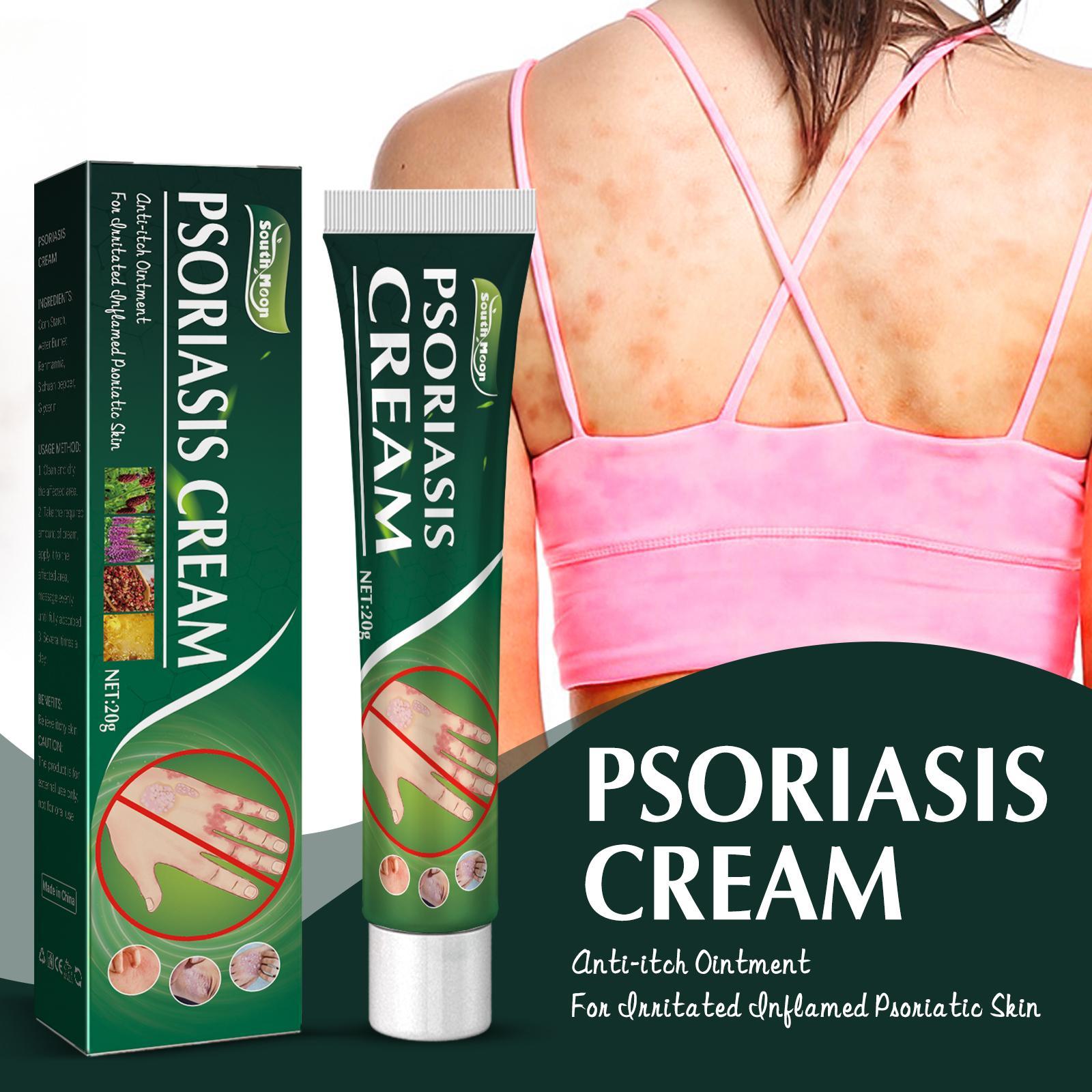 Obat Herbal Alami Murni, Tanpa Reaksi Adverse Krim Pe Psoriasis 20g Formula Aman Dengan Kekuatan Kulit, Meningkatkan Perasaan Dan Memperbaiki C4V2