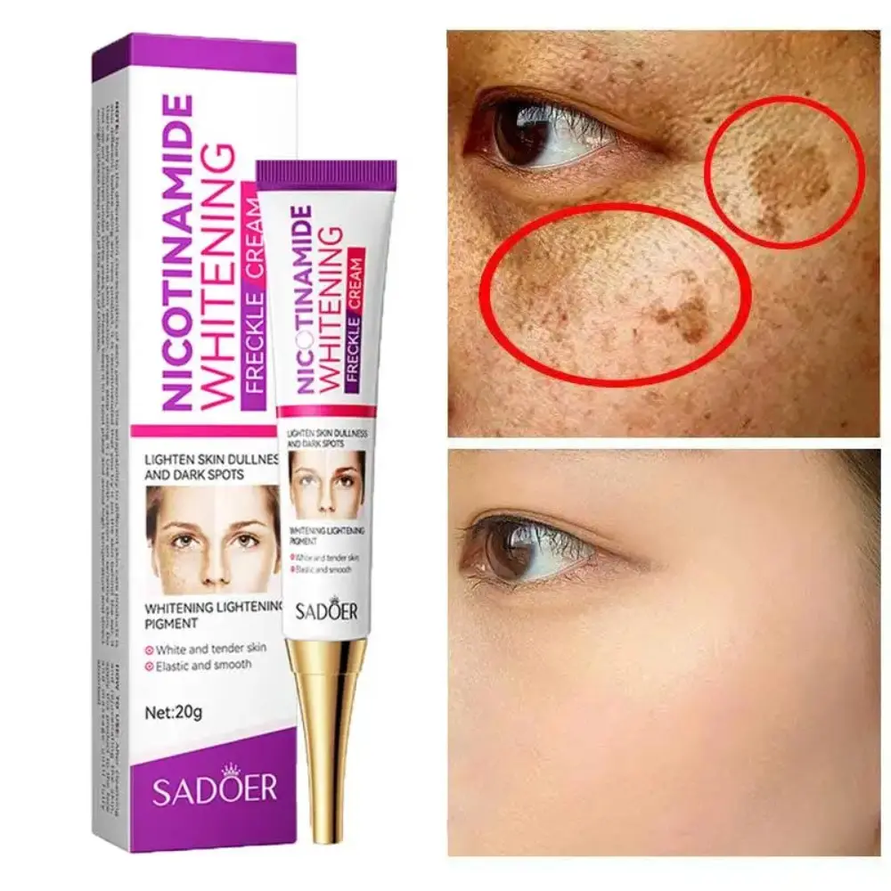 Skin Care Nicotinamide Whitening Cream Brightening Fade Color Spots Freckles Cream Skin Hydration Remove Melasma Moisturize Cream Women