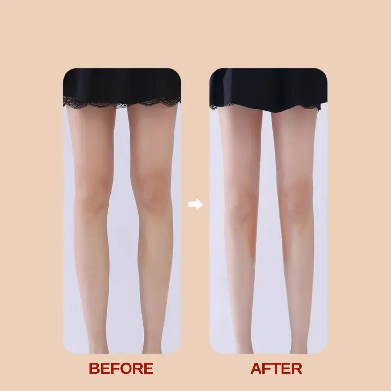 Miếng Dán Chân Thẳng M001 - Keo Silicone Định Hình Chân Cao Cấp - Đinh, Women