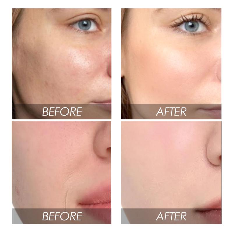 Product Introduction of EELHOE Avocado Watermelon Facial Serum Fades Fine Lines Tightens Pores Hydrates Moisturizes Whitens Essence 10