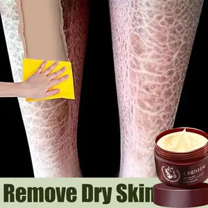 Horse Oil Hand & Foot Cream Obat Salep Kaki Pecah Dan Kering Ampuh Tangan Kulit Kapalan Cream Perbaikan Kulit