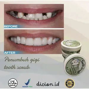 PENUMBUH GIGI ALAMI - Gigi Ompong Tertambal Lagi,Gigi Patah Rapih & Bersih Gigi Kropos, TERAMPUH!!!