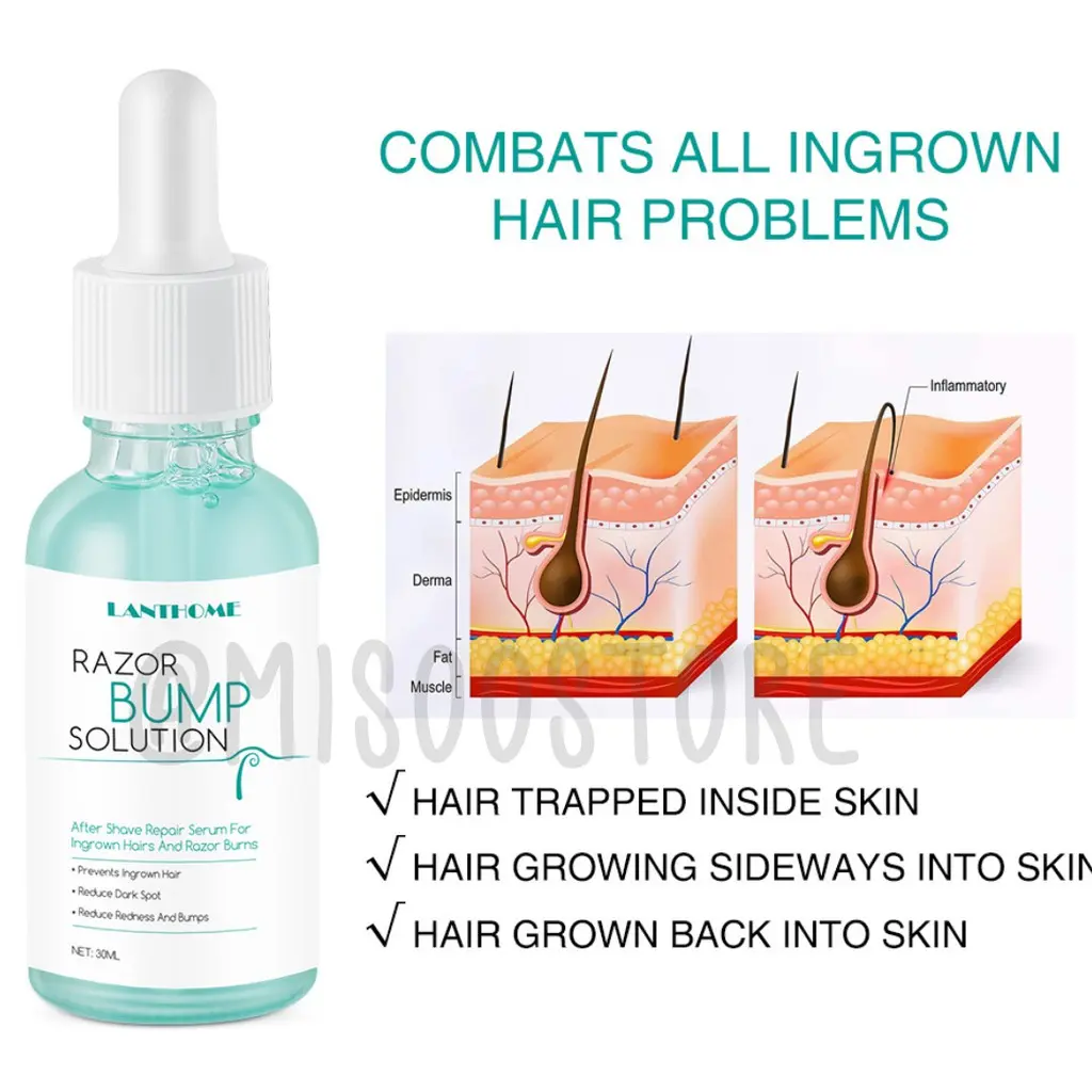 Lanthome razor bump solution 30ml serum untuk ingrown hair/razor bump stopper/anti bump