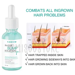 Lanthome razor bump solution 30ml serum untuk ingrown hair/razor bump stopper/anti bump