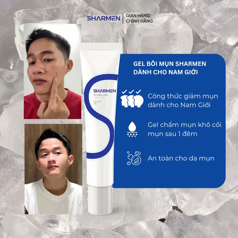 COMBO SMASH DUO Chăm Da Dầu Mụn Nam Giới - 1 sữa rửa mặt 1 Gel Bôi mụn SHARMEN cho Nam Giới - Sạch sâu, giảm mụn, kiềm dầu dưỡng sáng mờ thâm 7