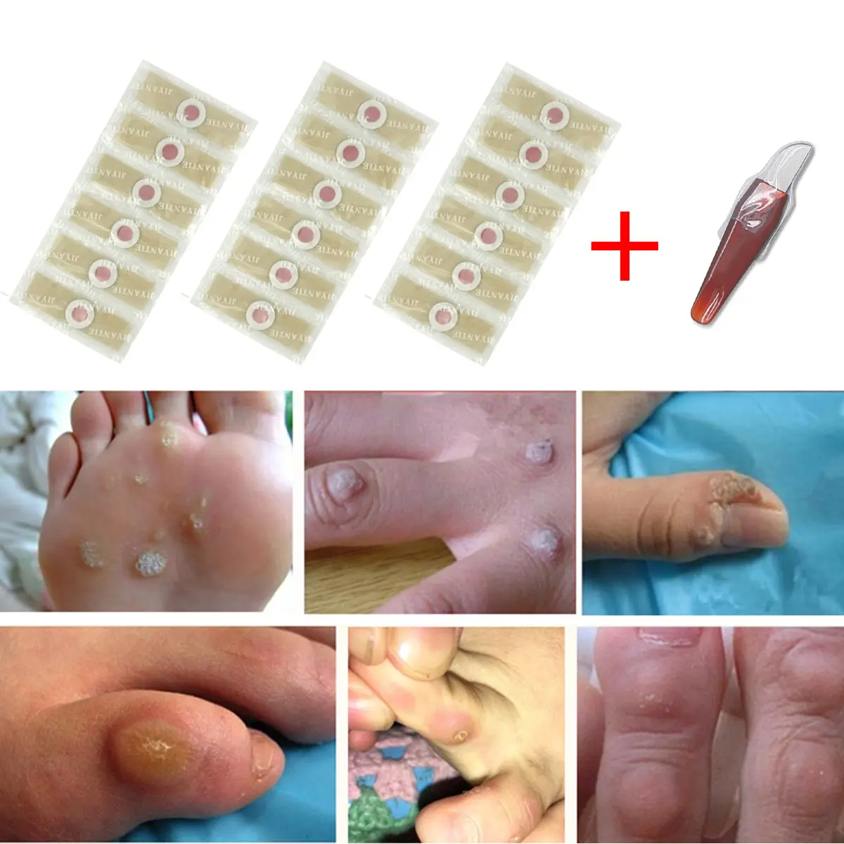 Set, corn sticker, anti-wear sticker to remove calluses, calluses, hands, feet, cocoons and feet, easy foreign trade supply