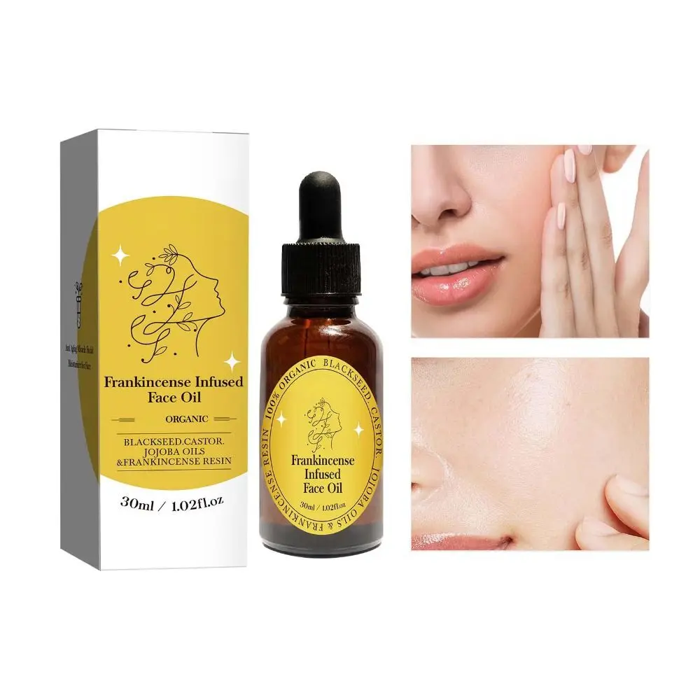 Hot Infused Organic Frankincense Resin Oil Castor and Jojoba Moisturizing Frankincense Oil Black Seed Anti-Aging Facial Serum for Face