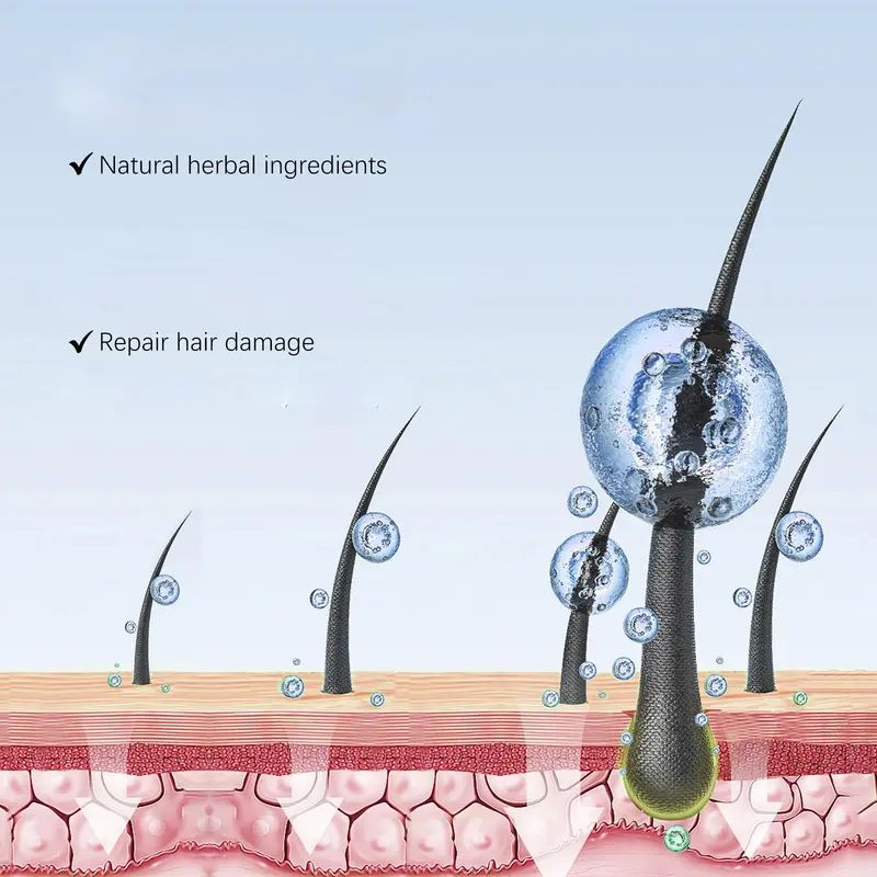 Serum with Micro Needle Roller, 1 Box Hair Thickening & Lengthening Serum, Men and Women Hair Care Product 4