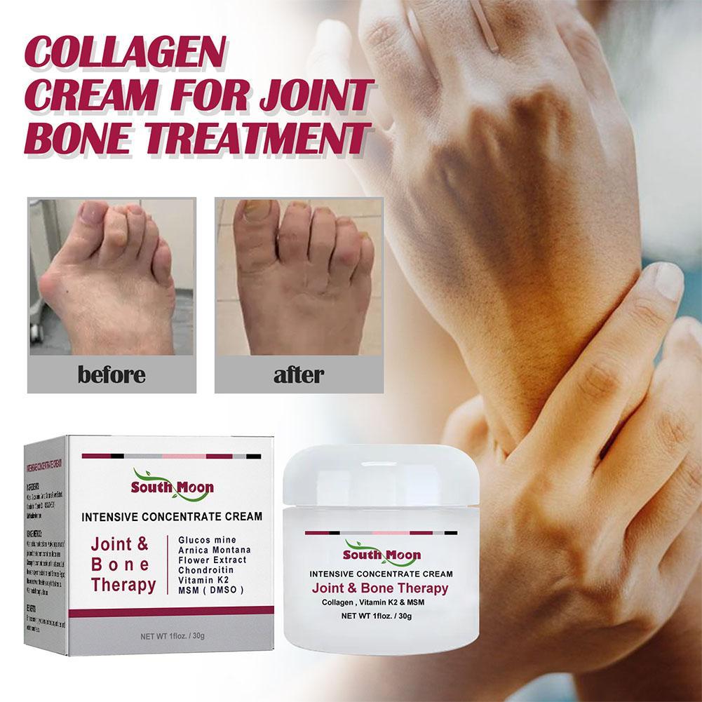 South Moon Joint Bone Therapy Intensive Concentrate Dan Pengobatan Terapi Sendi Krim Pereda Y9R3