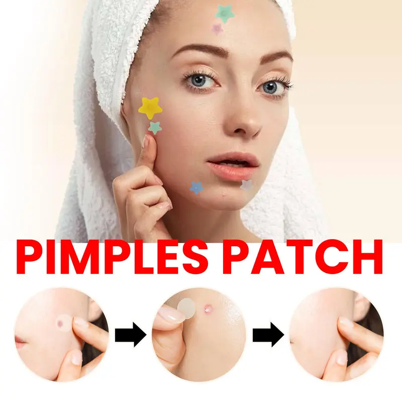 Star Shaped Acne Patches, 5 Sheets/box Hydrocolloid Acne Covering Patches, Facial Skin Care Products for Women & Men 4