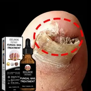 jamur kuku kuku jamur dan rusak perawatan kuku kuku jamur dan rusak Pemutih Kuku Penghilang Jamur Kuku serum [T83]