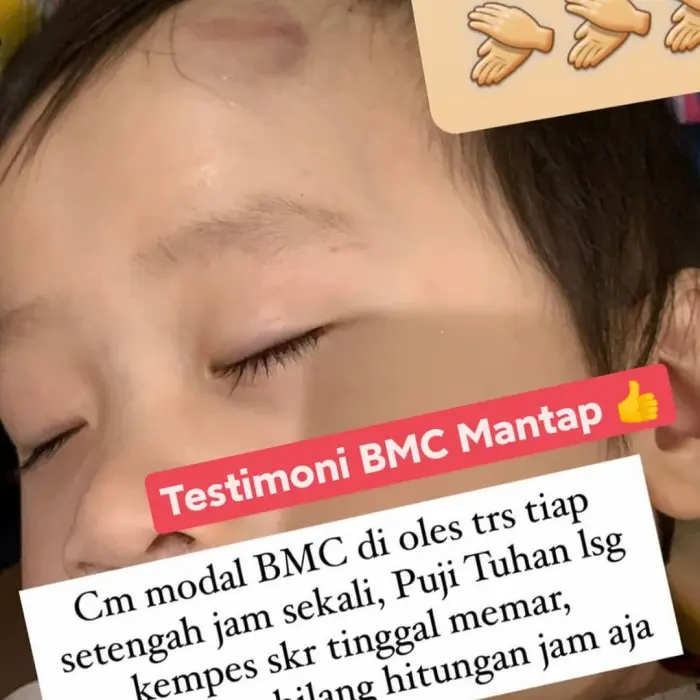 Krim Untuk Luka Bakar BMC (Bio Cream 30 gr) KK Indonesia Menggunakan Nano Techonolgy, Berbahan dasar Herbal, Membantu meringankan iritasi kulit, Melembabkan dan Mendinginkan Kulit, Menyembuhkan Hidung tersumbat/Flu, Keseleo, Ketombe dll 5