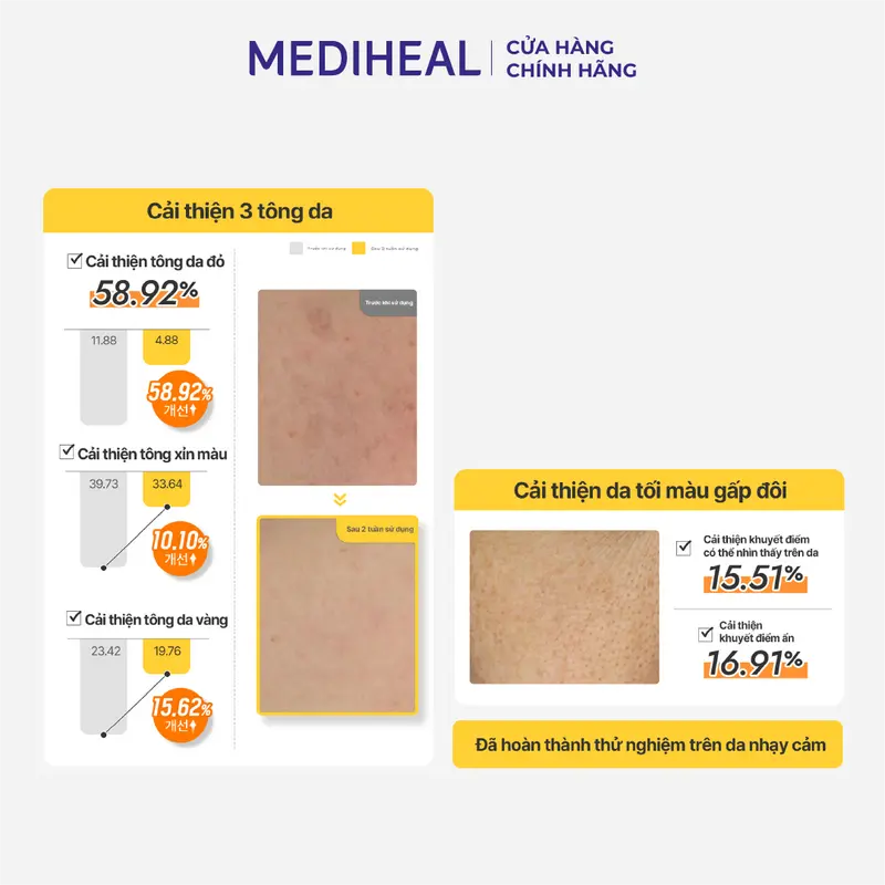 [Cơ Hội Cuối 24.05] Toner Pad MEDIHEAL Hỗ Trợ Làm Sáng Và Đều Màu Da Mediheal Vitamide Brightening Pad 180ml 100 Pads 5