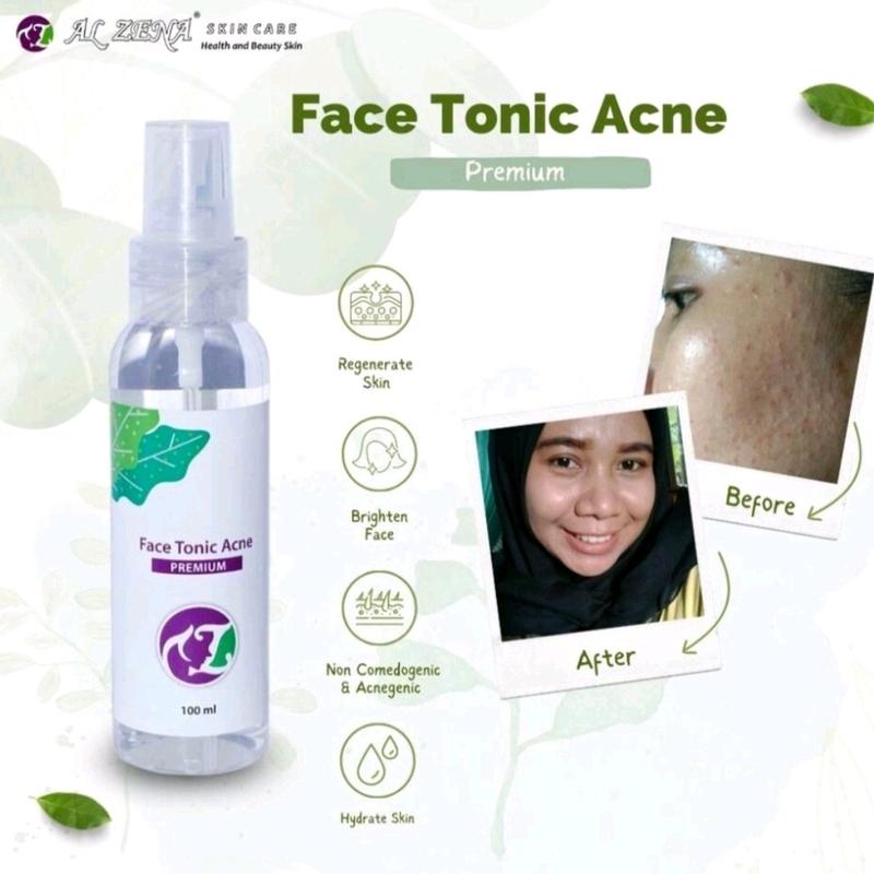 TONER ALZENA SKINCARE 100% ORI BPOM 0