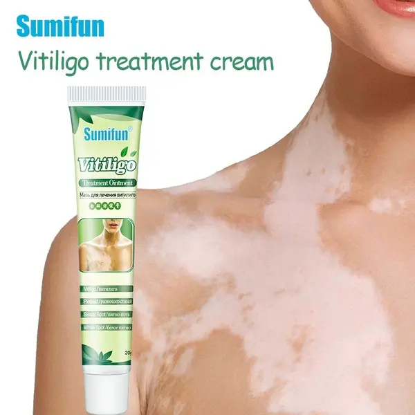 Obat Penghilang Vitiligo Salep Krim Vitiligo Kulit Bercak Belang Bintik Putih Paling Ampuh 20 gr Bebas Paraben 6