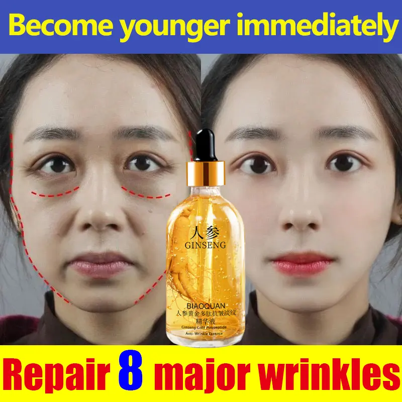 Anti wrinkle ginseng hyaluronic acid essence 100ml Anti aging moisturizing whitening ginseng extract