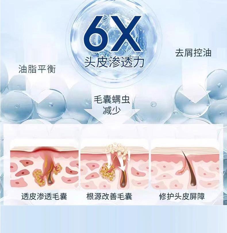 Product Introduction of Xikangwang Anti-Dandruf and Relieve Itching Washing Water Oil Removing Refreshing Skin Washing Cream Anti-Mite Grease-Overflow Moss Lotion 16