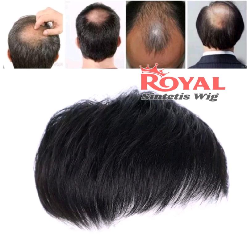 WIG PRIA PENDEK / TOUPEE TUTUP BOTAK / WIG RAMBUT PENUTUP KEBOTAKAN 2