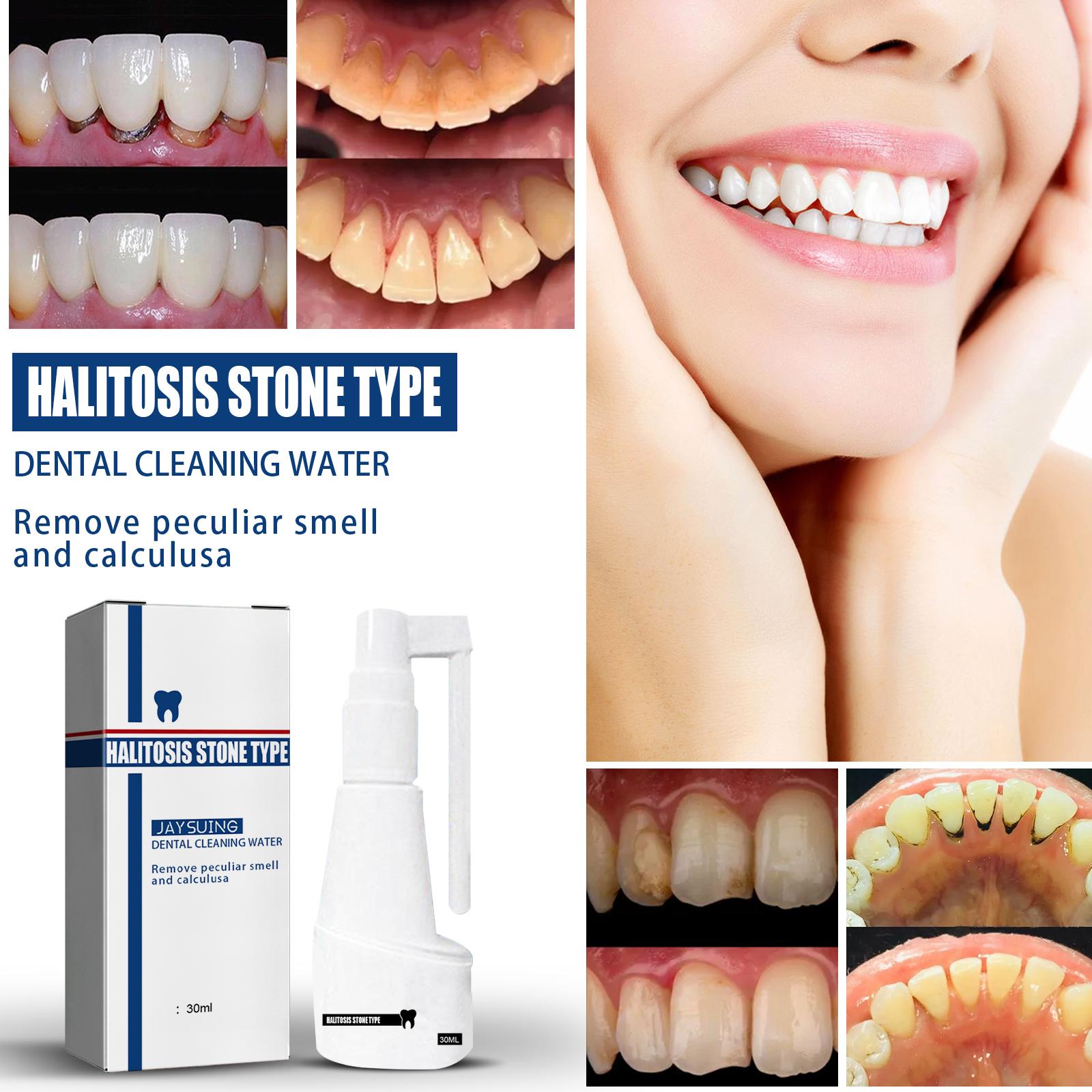 Penghilang Tartar Jaysuing Penghilang Tartar Pemutih Gigi Semprotan Penghilang Bau Mulut