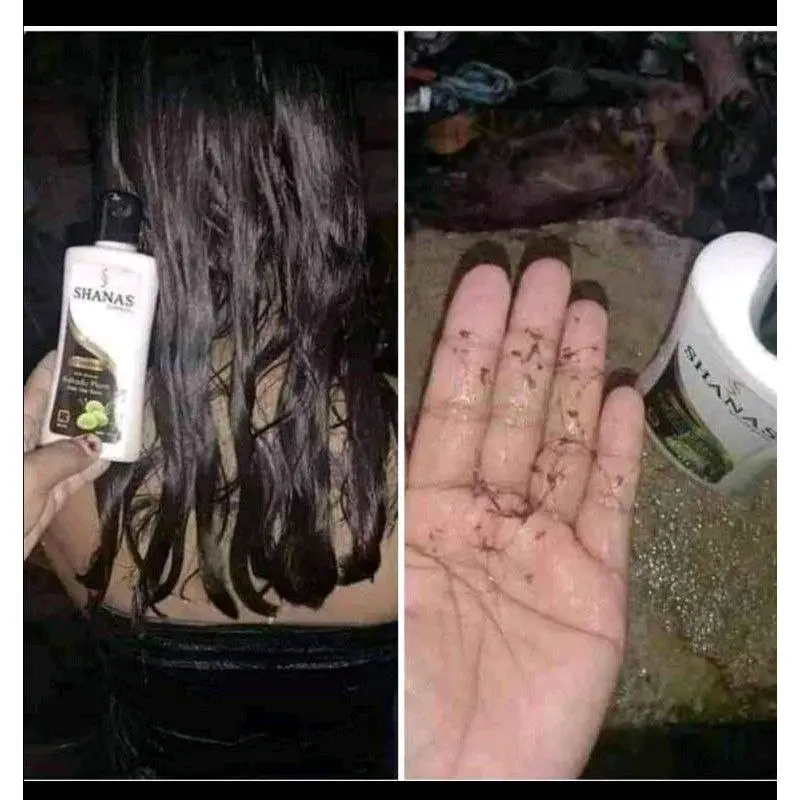 shampo shanas