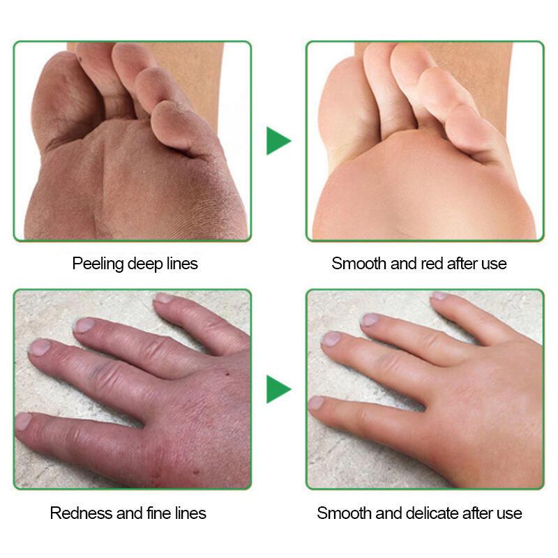 Product Introduction of Sumifun Hand Foot Dry and Cracking Cream K10048 12