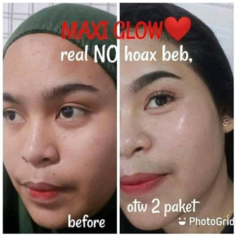 Paket Perawatan Kulit Maxie Glow - Sabun, Toner, Cream Siang & Malam - Mencerahkan, Bersihkan, Muka 1