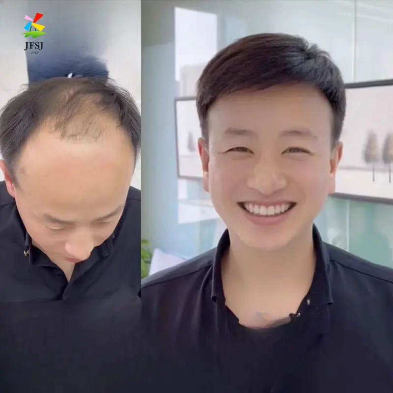 Wig Pria dengan Rambut Pendek, Potongan Rambut Pengganti Kepala Tak Terlihat Yang Tampan, Rambut Kepang Tipis dan Ringan Alami, Potongan Wig Pria Botak