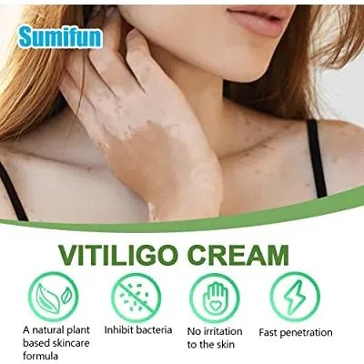 Obat Penghilang Vitiligo Salep Krim Vitiligo Kulit Bercak Belang Bintik Putih Paling Ampuh 20 gr Bebas Paraben 5