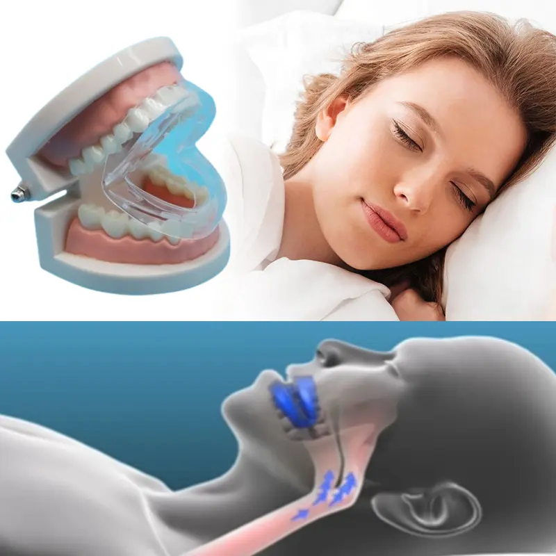 Ống Ngậm Mài, Bộ Chống, Bảo Vệ Miệng, Tùy Chỉnh, Đúc Và Điều Chỉnh Có Thể Điều Chỉnh, Kèm Hộp Đựng 0