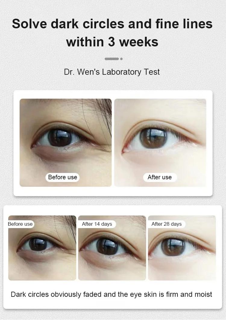 Dinkiss Eye Treatment Oil Improve Skin Radiance Reduce Wrinkles Relieve Puffiness