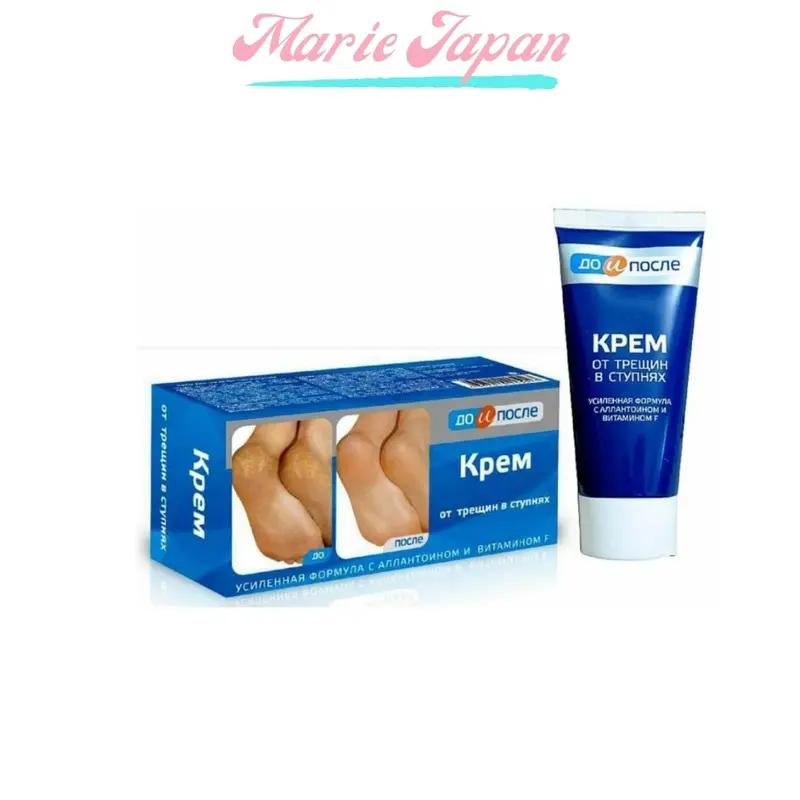 Kem Hỗ Trợ Giảm Nứt Gót Chân Nữ Kpem Nga Chính Hãng 50ml Cosmetic Women 0