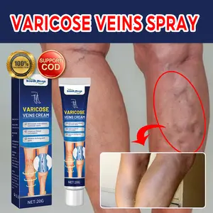 South Moon Varicose Veins Cream Obat Varises Salep Penghilang Varises Vaskulitis 20g