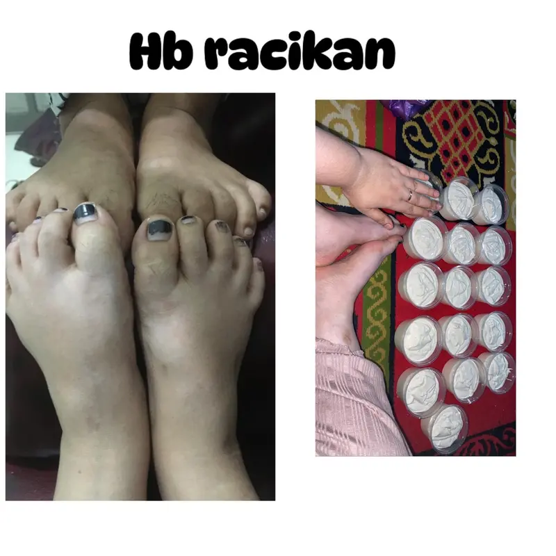 HB DOSTING PEMUTIH BADAN 2