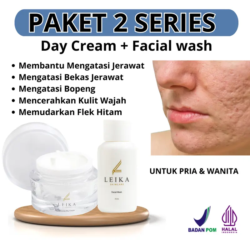 Paket 2in1 Leika skincare series penghilang jerawat dan bekasnya penghilang jerawat paling ampuh penghilang bekas jerawat bopeng Obat jerawat bruntusan skincare jerawat paket acne Perawatan Wajah Berjerawat 0