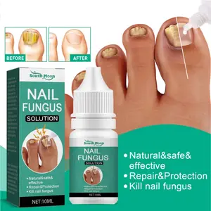 Nail Treatment Feet Care Essence Nail Foot Whitening Toe Nail Fungus Perawatan Kuku