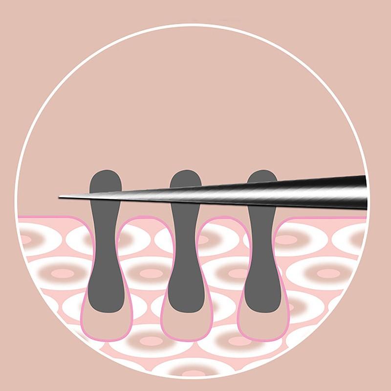 Nhíp Kẹp Mụn Trứng Cá Tế Bào, 8CM, Dụng Cụ Làm Đẹp, Chuyên Nghiệp, Chà Và Đóng, Dụng Cụ Trị Mụn, Đặc Biệt Cho Thẩm Mỹ Viện 2